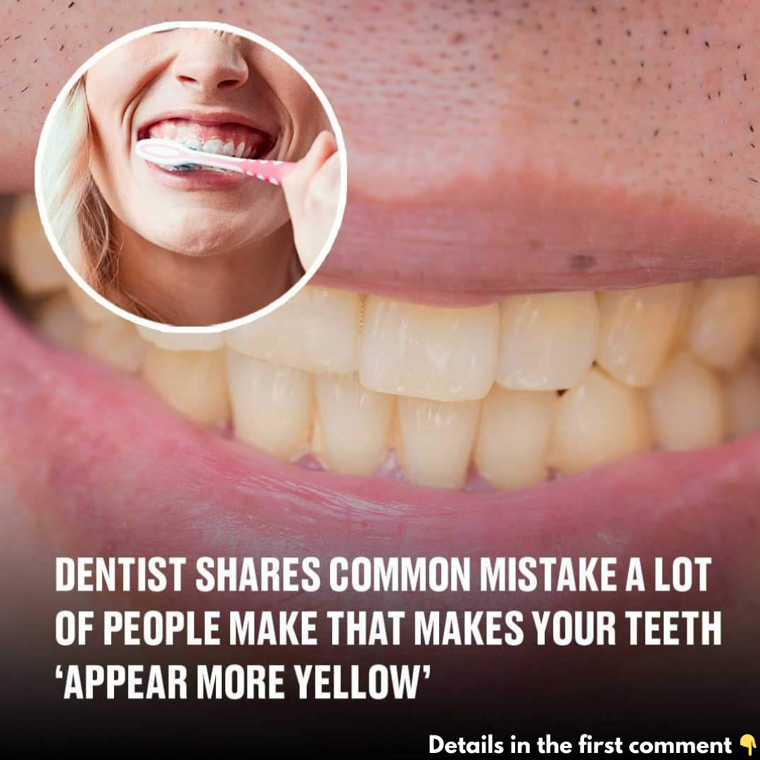 People Often Make This Mistake Which Leads to Yellow Teeth, Dentist Says