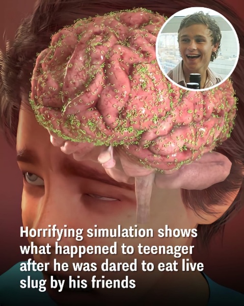 Horrifying simulation shows what happened to teenager after he was dared to eat live slug by his friends