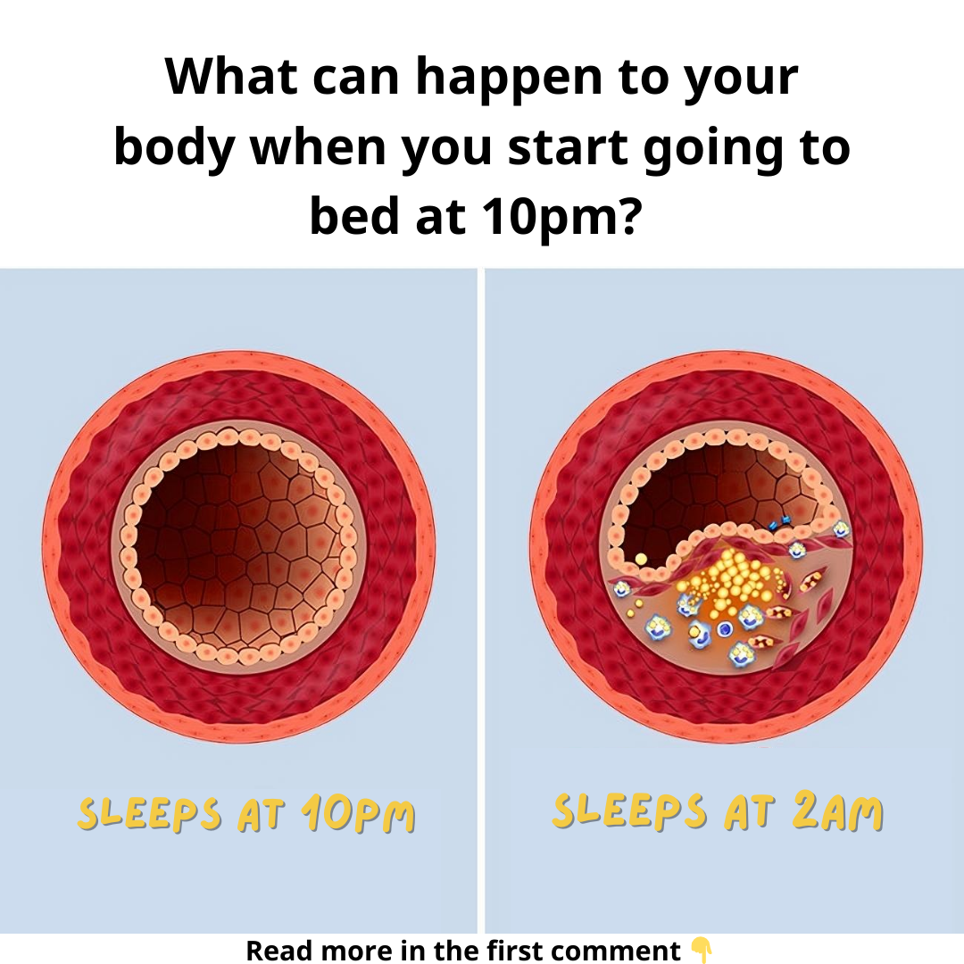 What can happen to your body when you start going to bed at 10 p.m