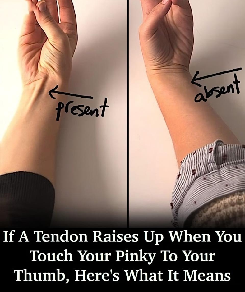 If a Tendon Raises Up When You Touch Your Pinky to Your Thumb, Here’s What It Could Mean