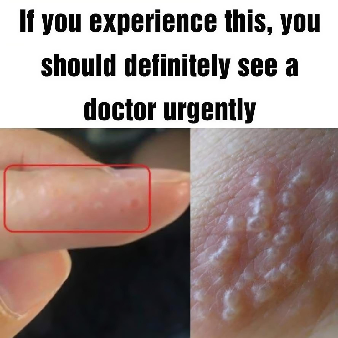 If You Notice Painful Red Bumps, You Might Have Dyshidrotic Eczema