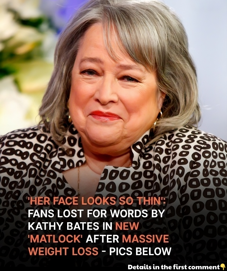 New ‘Matlock’ with ‘So Thin’ 76-Year-Old Kathy Bates Is on Everyone’s Lips: ‘OMG, What Happened to Her?’