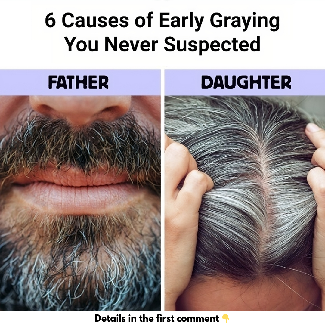 6 Causes of Early Graying You Never Suspected