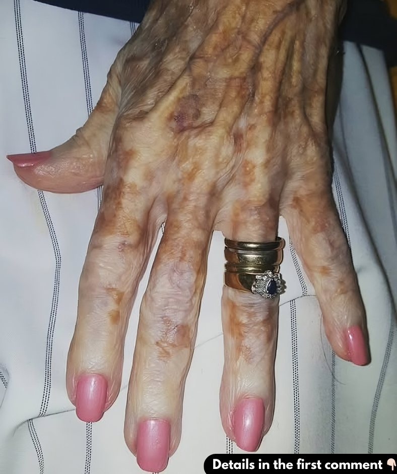 This Nurse’s Photo of an Old Lady’s Hand Has People Around the World in Tears