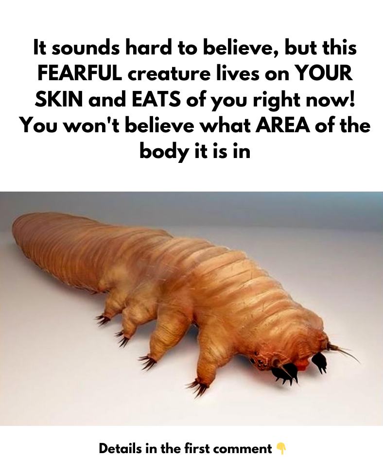 This FEARFUL creature lives on YOUR SKIN and EATS of you right now!