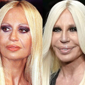 Donatella Versace: A Trailblazer of Fashion, Resilience, and Self-Expression