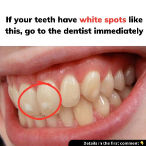 For those who don’t know For those who don’t know
