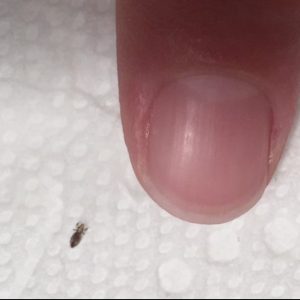 If you find this bug in your hair. How to get rid of them and stop them coming back