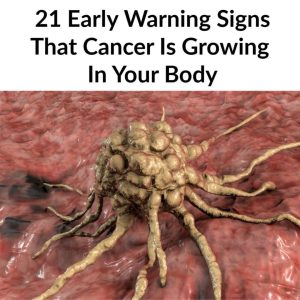 20 Early Signs Your Body is Fighting Cancer