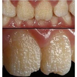 Be careful!! This is what your teeth will become when you eat… Be careful!! This is what your teeth will become when you eat…