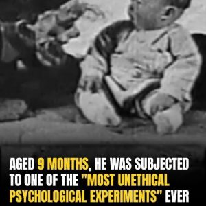 The Heartbreaking Fate Of ‘Little Albert’: Child Subject Of Historic Study Died At Just Six The Heartbreaking Fate Of ‘Little Albert’: Child Subject Of Historic Study Died At Just Six