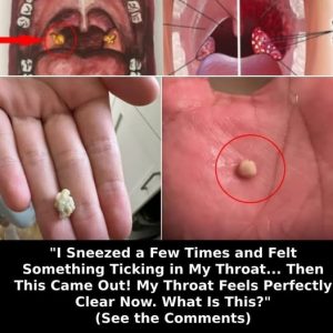 Here’s What You Need to Know Here’s What You Need to Know