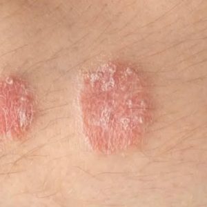 Warning signs you should never ignore on your skin Warning signs you should never ignore on your skin