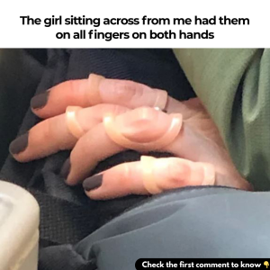 A Strange Sight on the Bus: What Was This Girl Really Wearing on Her Hands?